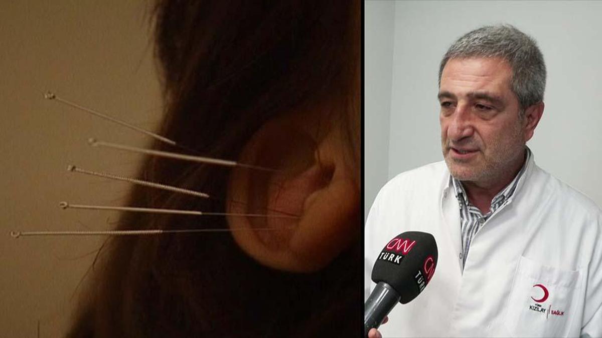 Akupunktur tedavisi nasıl uygulanıyor?