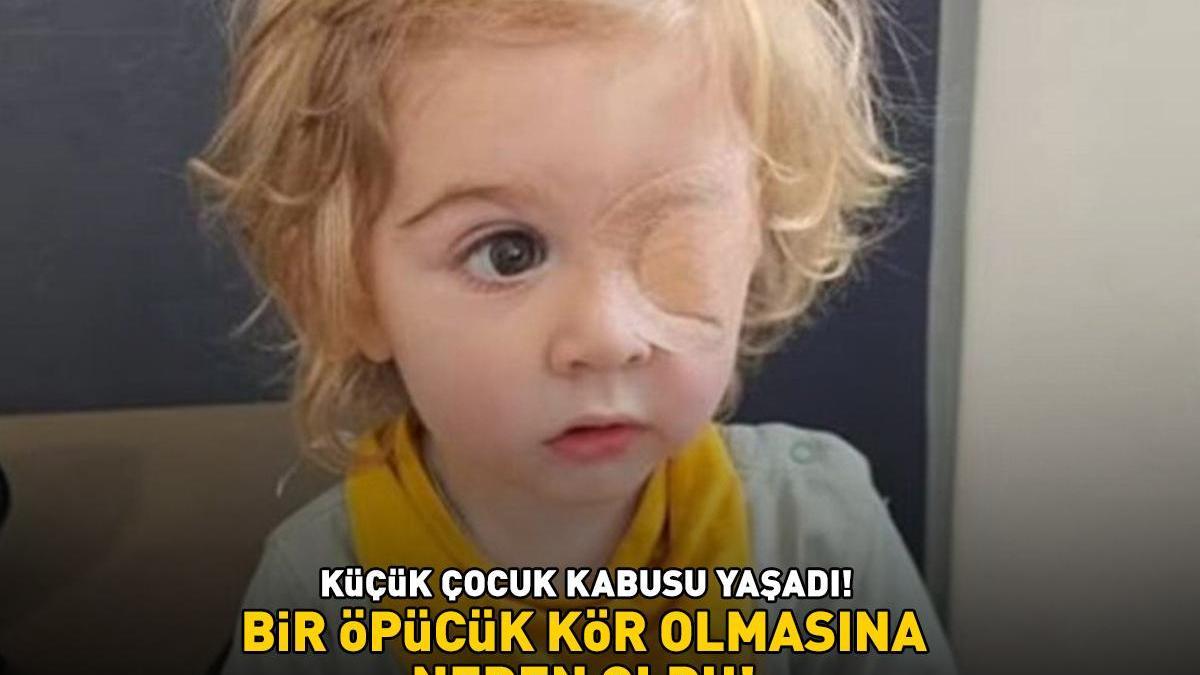 Bir öpücük kör olmasına neden oldu! Küçük çocuk kabusu yaşadı: Önce korneasında 4 mm’lik bir delik açıldı, sonra…